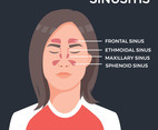 Vector Sinus illustration