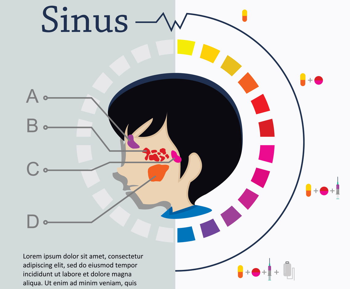 Flat Face And Sinus Illustration
