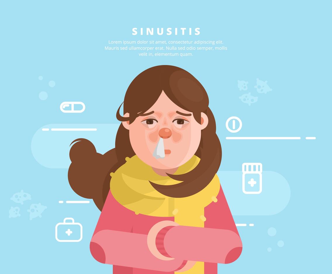 Sinus Illustration