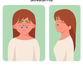 Sinusitis Disease Sinus Anatomy Illustration