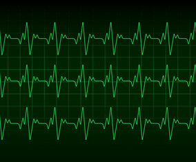 Heartbeat Monitor Vector