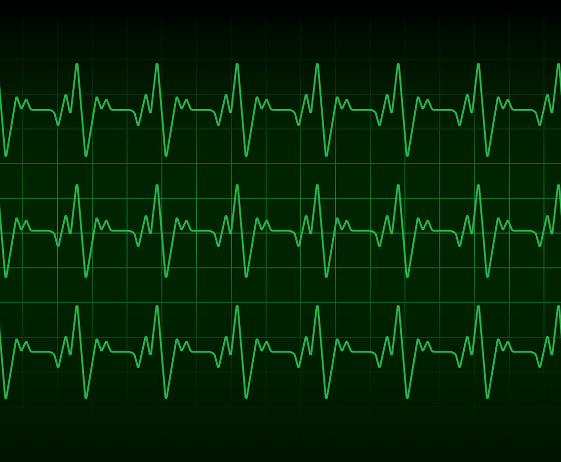 Heartbeat Monitor Vector