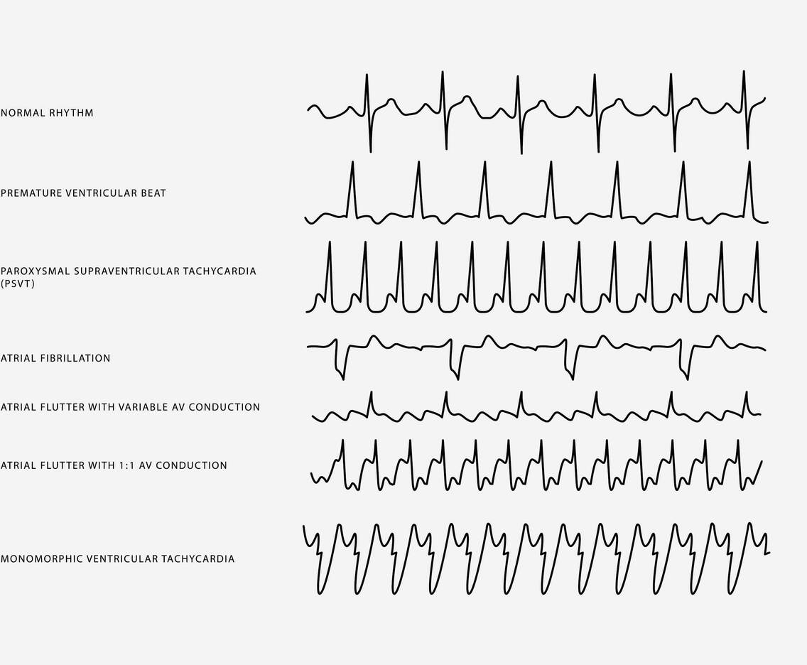 Heart Rhythm Set Vector