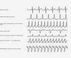 Heart Rhythm Set Vector