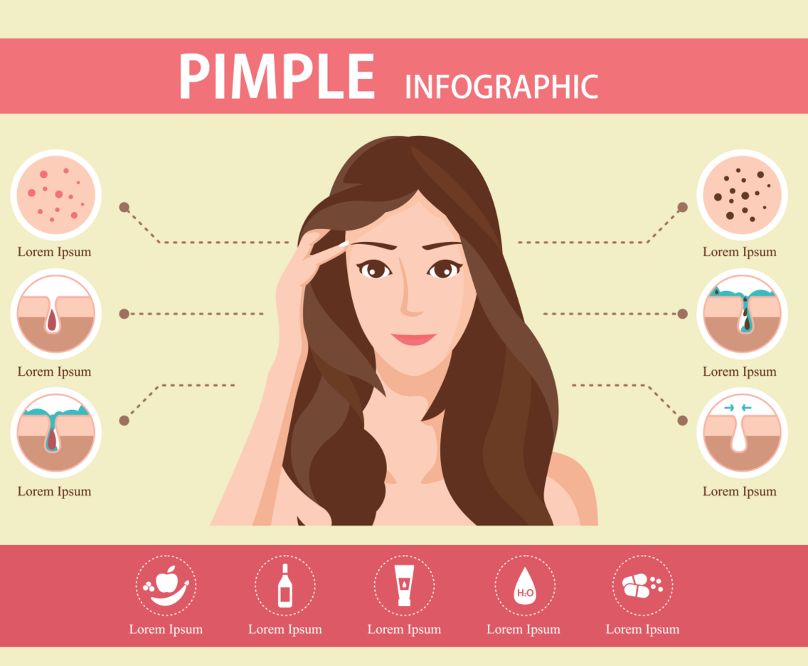 Pimple Infographic