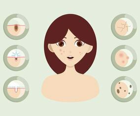 Pimple Illustration