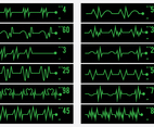 Electrical Activity Human Pulse Icon