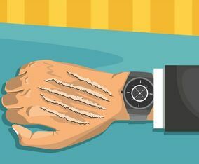 Scratch Marks Vector Design