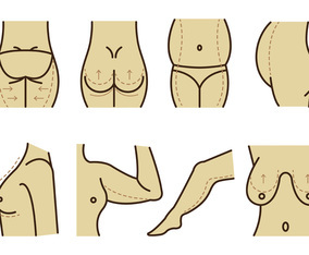 Set Of Plastic Surgery Vector