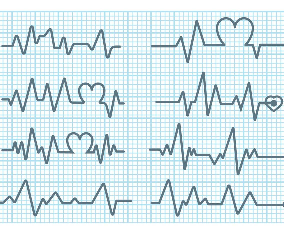 Heart Monitor Vector