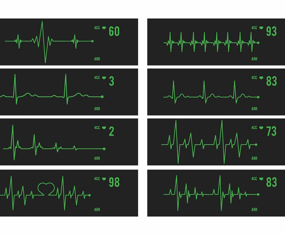 Vector Heart Monitor Set