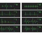 Vector Heart Monitor Set