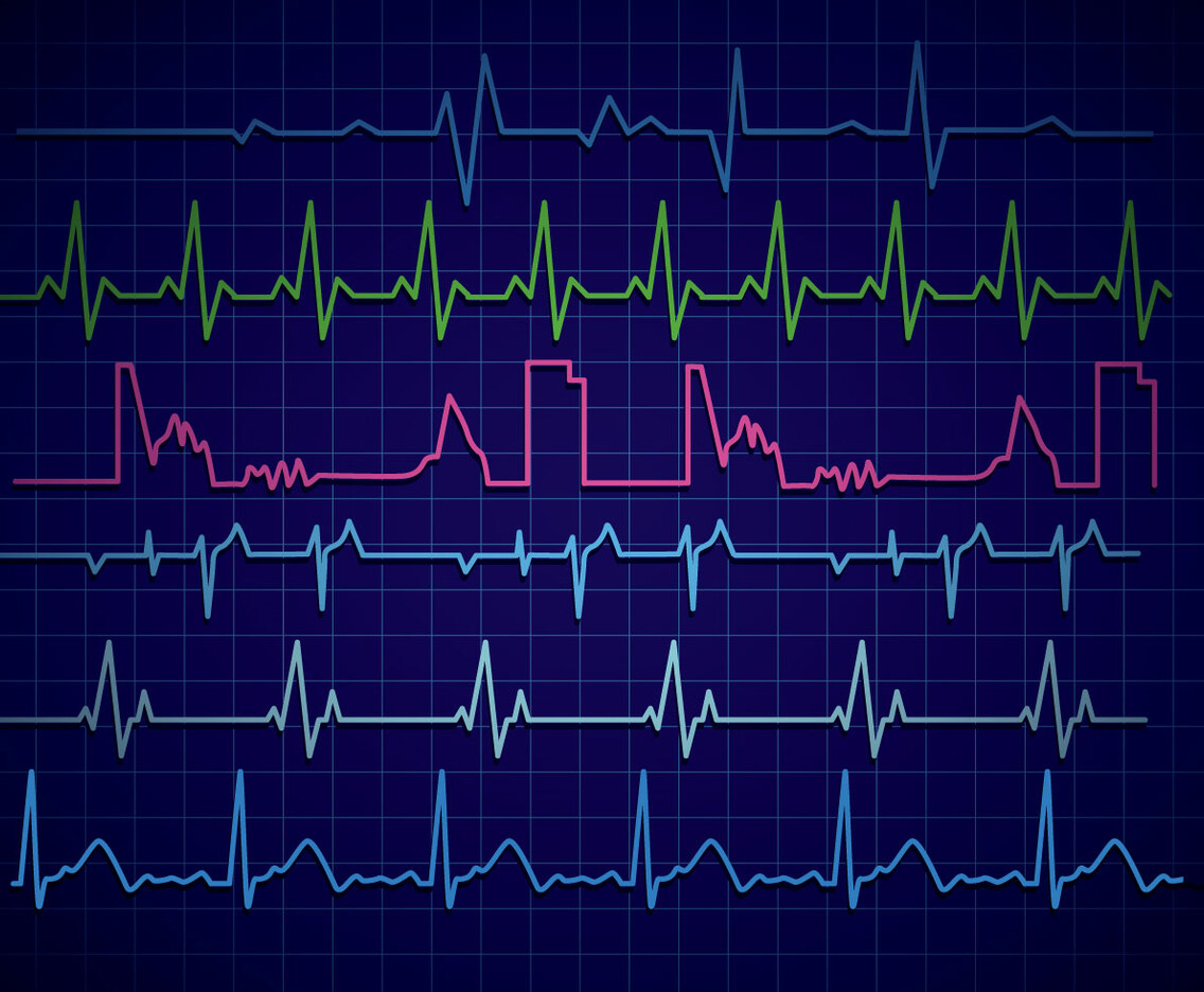Heart Monitor Vector