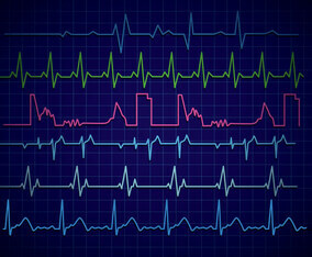 Heart Monitor Vector