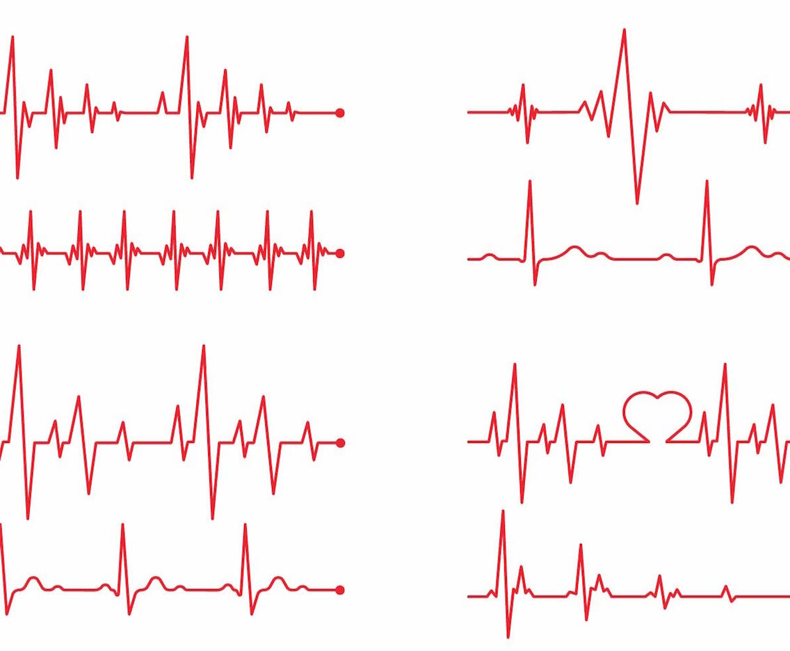 Heart Monitor Vector Set