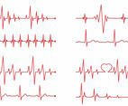 Heart Monitor Vector Set