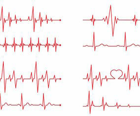 Heart Monitor Vector Set