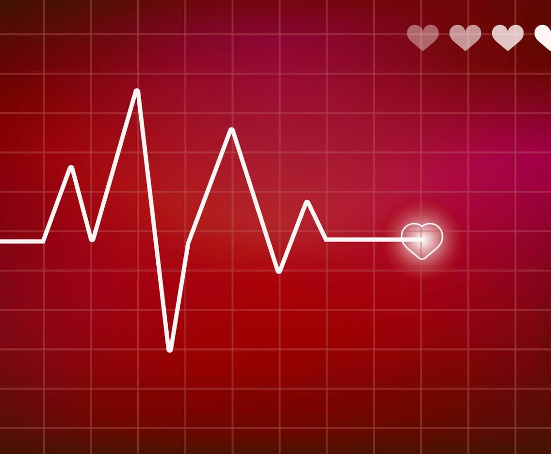 Heart Monitor Vector. Ekg.