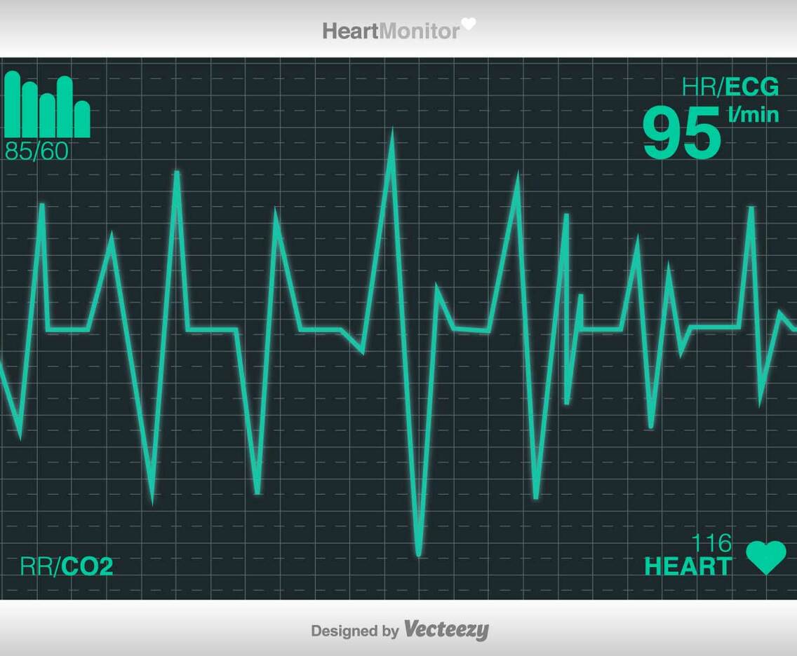 Vector Cardiogram Of Heart