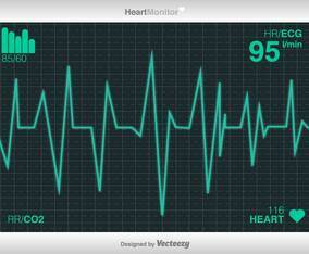Vector Cardiogram Of Heart