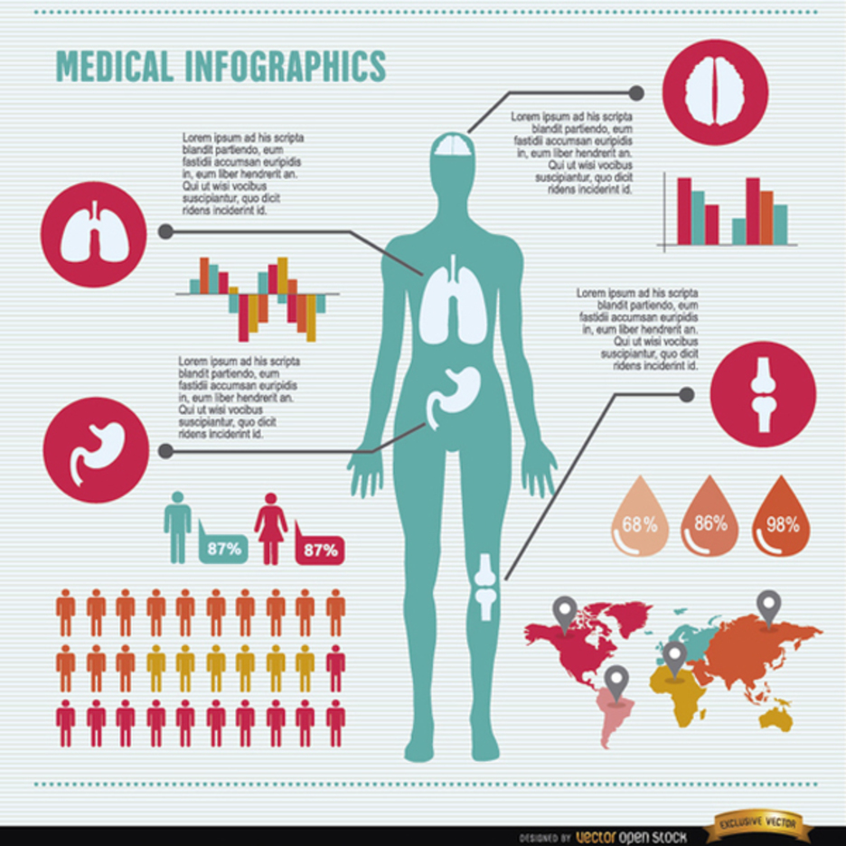 Female breast surgery infographic chart. Vector flat medical